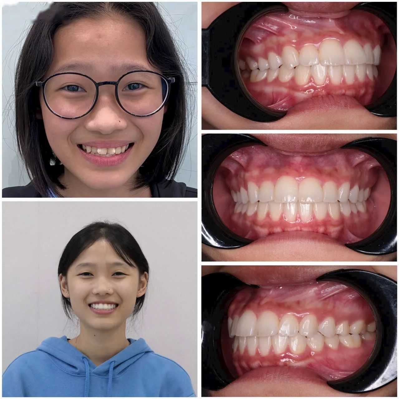 Cas clinique 01