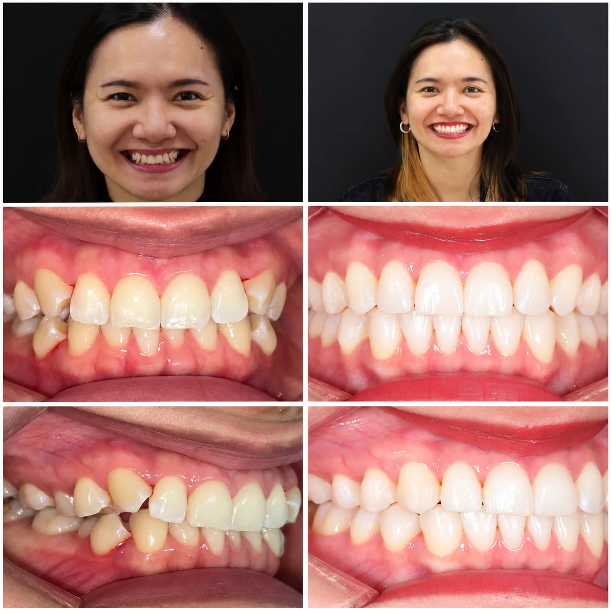 Cas clinique 02