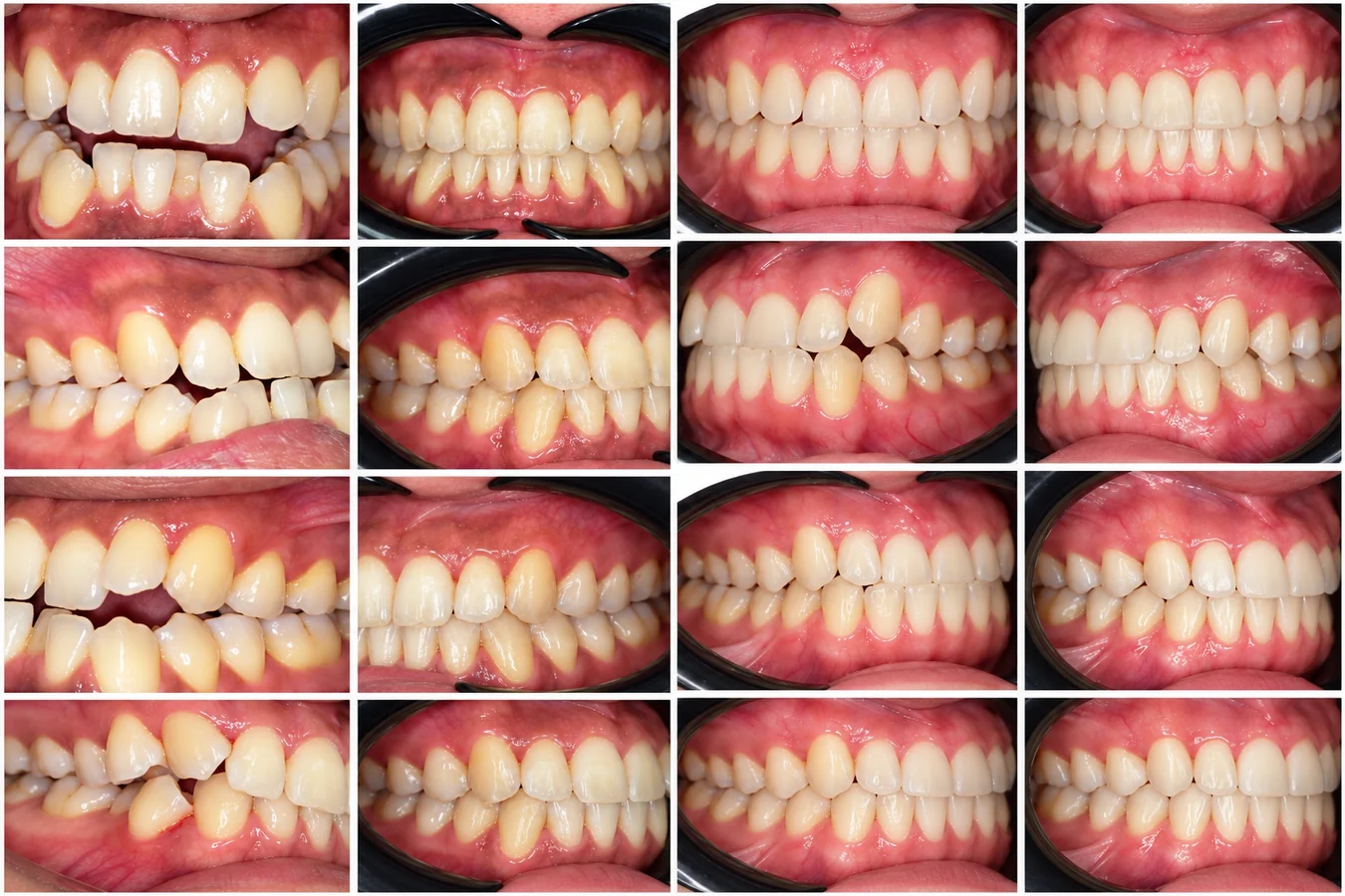 Cas clinique 03